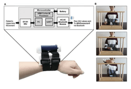 Quantitative Assessment of Upper Limb Motor Function in Ethiopian Acquired Brain Injured Patients Using a Low-Cost Wearable Sensor